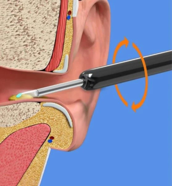Wireless WIFI Visual Ear Pick - Image 4
